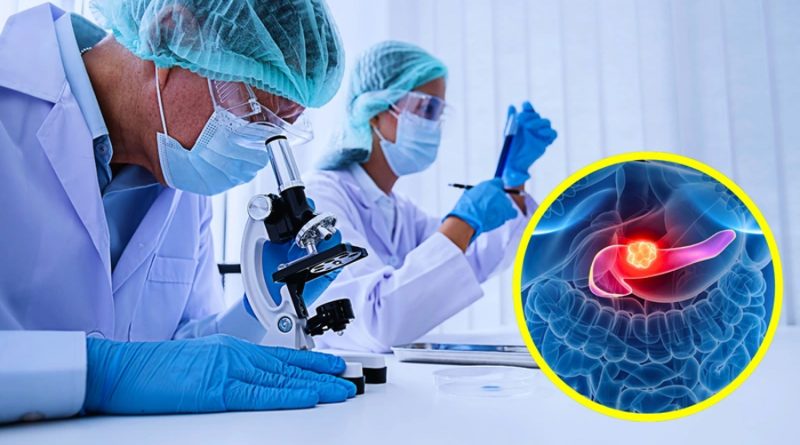 Investigadores descubren señal que anticipa el cáncer de páncreas: así podría salvar miles de vidas