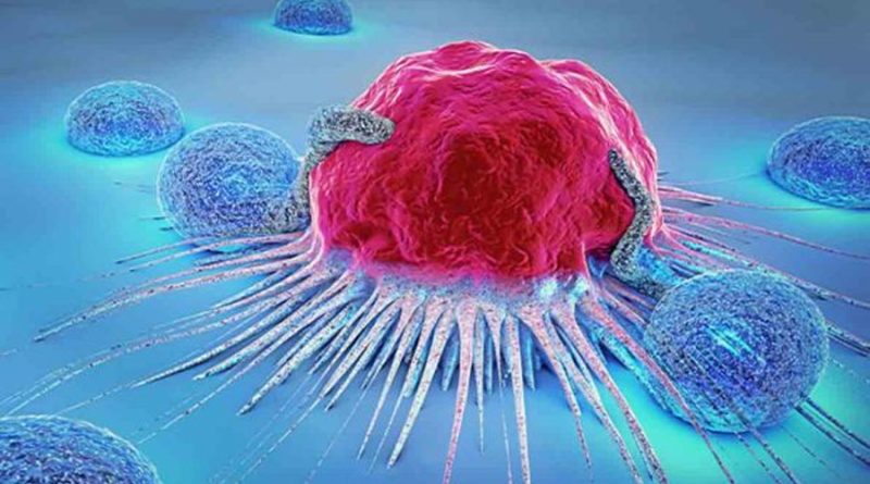 Nueva tecnología que detecta recaídas de cáncer de mama con hasta 5 años de antelación