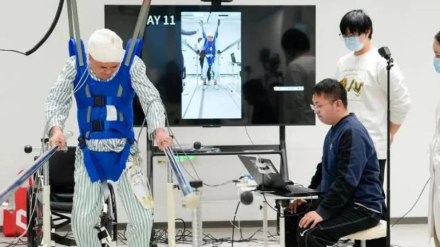 China devuelve la movilidad a personas paralizadas con un nuevo chip cerebral