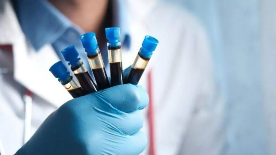 Hemofilia; trastorno de la coagulación que afecta a más de 7 mil mexicanos