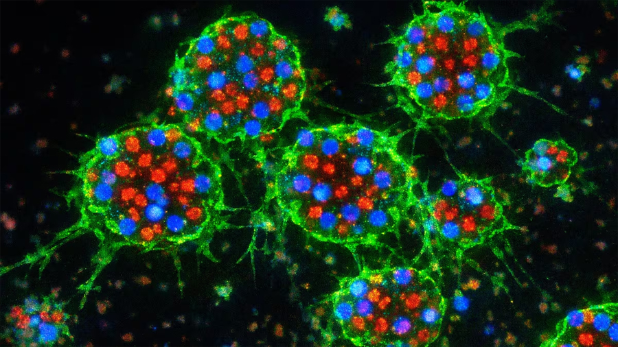 Investigadores logran un impresionante avance en la medicina regenerativa: crean riñones artificiales
