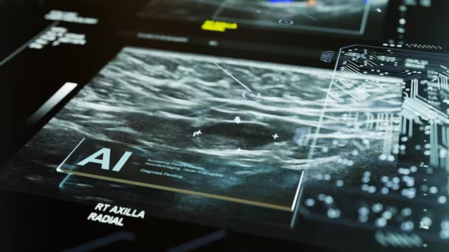 La IA detecta riesgos cardíacos ocultos a partir de mamografías