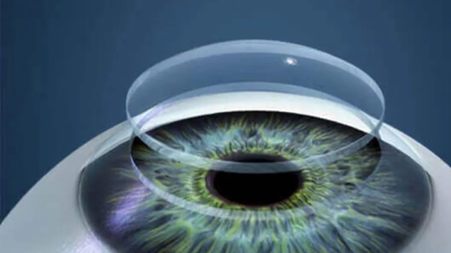 Adiós a la ceguera: científicos crean un novedoso implante de córnea a partir de escamas de pescado