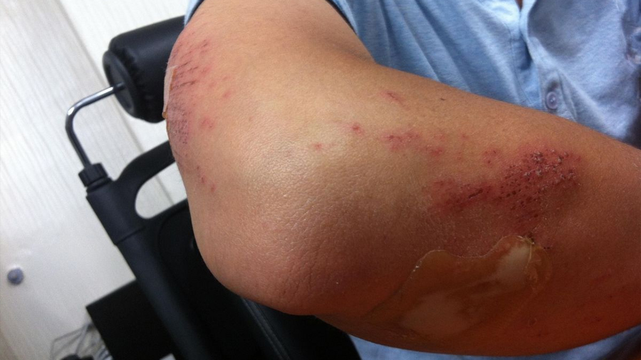 Científicos de la UCO crean un vendaje con paja y hongo asiático para acelerar la cicatrización